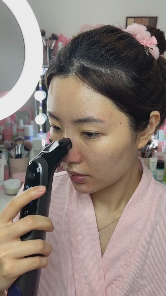 Blackhead Remover Pore Vacuum - Electric Facial Cleanser
